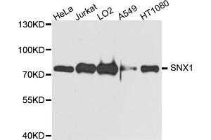 Western blot analysis of extracts of various cell lines, using SNX1 antibody. (Sorting Nexin 1 anticorps)