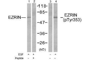 Image no. 1 for anti-Ezrin (EZR) (Tyr353) antibody (ABIN197258) (Ezrin anticorps  (Tyr353))