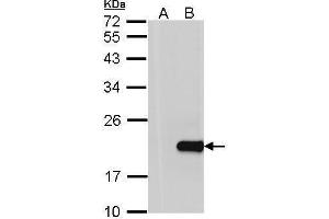 WB Image Western Blot analysis of HPCAL1 expression in transfected 293T cell line by HPCAL1 polyclonal antibody. (HPCAL1 anticorps)