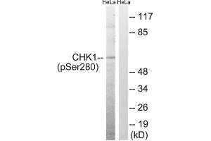 Western Blotting (WB) image for anti-Checkpoint Kinase 1 (CHEK1) (pSer280) antibody (ABIN1847455) (CHEK1 anticorps  (pSer280))