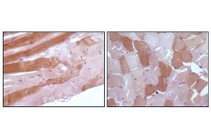 Immunohistochemical analysis of paraffin-embedded human skeletal muscle tissue showing cytoplasmic localization using anti-Myoglobin antibody with DAB staining. (Myoglobin anticorps)