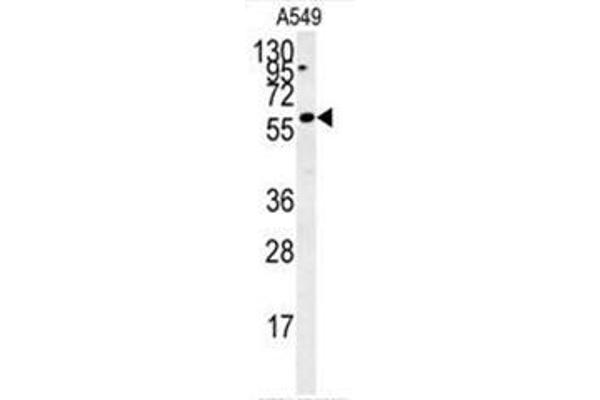PARPBP anticorps  (C-Term)