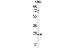 anti-Ribulose-5-Phosphate-3-Epimerase-Like (RPEL1) antibody
