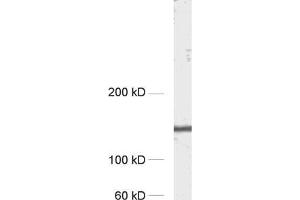 dilution: 1 : 1000, sample: rat hippocampus homogenate