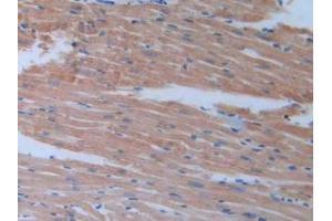 Detection of BCAN in Mouse Heart Tissue using Polyclonal Antibody to Brevican (BCAN)