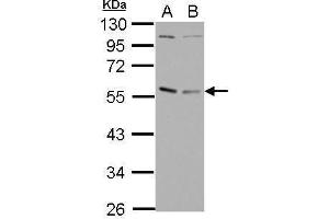 WB Image Sample (30 ug of whole cell lysate) A: Raji B: K562 10% SDS PAGE antibody diluted at 1:1000 (GABPA anticorps  (N-Term))