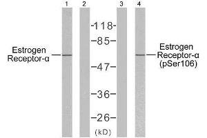 Western blot analysis of extracts from MCF7 cells using Estrogen Receptor-α (Ab-106) antibody (E021066) and Estrogen Receptor-α (phospho-Ser106) antibody (E011071). (Estrogen Receptor alpha anticorps)