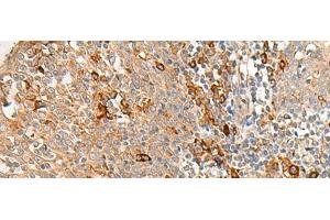 Immunohistochemistry of paraffin-embedded Human tonsil tissue using RNF207 Polyclonal Antibody at dilution of 1:40(x200) (RNF207 anticorps)