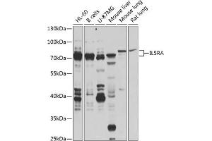 Western blot analysis of extracts of various cell lines, using IL5RA antibody (ABIN6132076, ABIN6142402, ABIN6142403 and ABIN6224648) at 1:1000 dilution. (IL5RA anticorps  (AA 20-335))