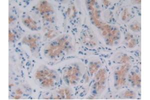 IHC-P analysis of Human Stomach Tissue, with DAB staining. (GDF6 anticorps  (AA 336-455))