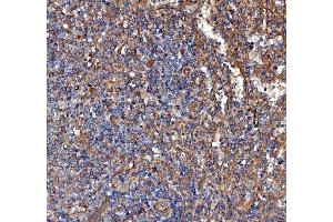 IHC analysis of Kindlin 2/FERMT2 using anti-Kindlin 2/FERMT2 antibody (ABIN7599515). (FERMT2 anticorps  (AA 1-650))