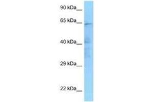 Image no. 1 for anti-Inhibitor of kappa Light Polypeptide Gene Enhancer in B-Cells, Kinase epsilon (IKBKE) (AA 158-207) antibody (ABIN6748243)