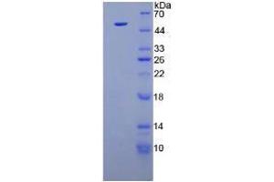 Fibroblast Growth Factor 1 (Acidic) (FGF1) (AA 1-155) (Active) protein (His tag,GST tag)