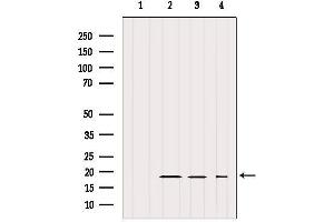 Western blot analysis of extracts from various samples, using IFT20 Antibody. (IFT20 anticorps)