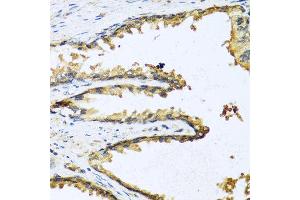 Immunohistochemistry of paraffin-embedded human prostate using GNRH1 antibody at dilution of 1:100 (40x lens). (GNRH1 anticorps)