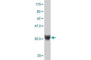 Western Blot detection against Immunogen (37. (ZNF207 anticorps  (AA 1-110))