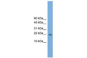WB Suggested Anti-PPIL3 Antibody Titration:  0. (PPIL3 anticorps  (Middle Region))