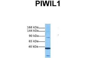 Host:  Rabbit  Target Name:  PIWIL1  Sample Tissue:  Human Fetal Liver  Antibody Dilution:  1. (PIWIL1 anticorps  (Middle Region))