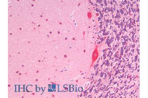 ABIN6391390 (5µg/ml) staining of paraffin embedded Human Cerebellum. (SLC7A6 anticorps  (C-Term))