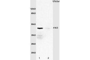L1 rat spleen lysates L2 mouse heart lysates probed with Anti IL-2R gamma/CD132 Polyclonal Antibody, Unconjugated  at 1:3000 for 90 min at 37˚C. (IL2RG anticorps  (AA 51-150))