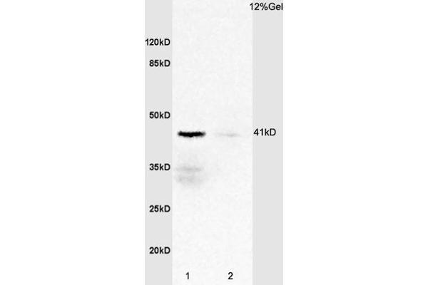 IL2RG anticorps  (AA 51-150)