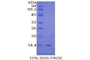 SDS-PAGE of Protein Standard from the Kit (Highly purified E. (S100B Kit CLIA)