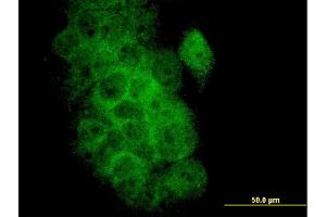 Immunofluorescence of monoclonal antibody to BCL2L1 on A-431 cell.