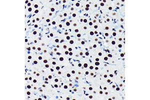 Immunohistochemistry of paraffin-embedded rat ovary using TDP-43/TARDB Rabbit mAb (ABIN7270730) at dilution of 1:100 (40x lens). (TARDBP anticorps)