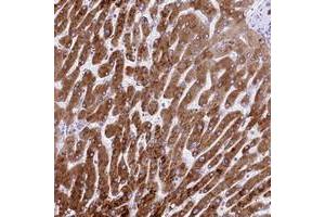 Immunohistochemical staining of human liver with RDH16 polyclonal antibody  shows strong cytoplasmic positivity in hepatocytes at 1:50-1:200 dilution.