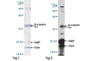 Kinase Activity Assay (KAA) image for Calcium/calmodulin-Dependent Protein Kinase IV (CAMK4) (AA 1-473) protein (GST tag) (ABIN1347939)