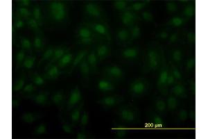 Immunofluorescence of monoclonal antibody to ARNT on HeLa cell.