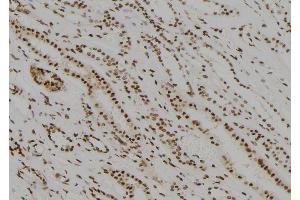 ABIN6279526 at 1/100 staining Human kidney tissue by IHC-P. (MED22 anticorps  (Internal Region))