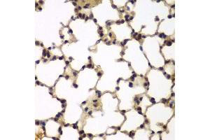 Immunohistochemistry of paraffin-embedded mouse lung using E2F6 antibody. (E2F6 anticorps)