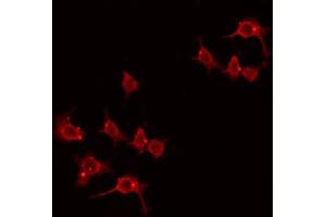 ABIN6274438 staining Hela by IF/ICC. (LMO3 anticorps  (C-Term))