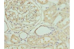 Immunohistochemistry of paraffin-embedded human kidney tissue using ABIN7161463 at dilution of 1:100 (ZNF274 anticorps  (AA 1-320))