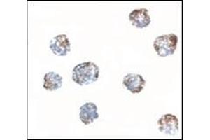 Immunocytochemistry of MATN3 in 3T3 cells tissue with this product at 2. (Matrilin 3 anticorps  (Center))