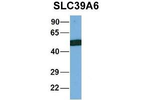 Host:  Rabbit  Target Name:  NOP56  Sample Type:  MCF7  Antibody Dilution:  1.