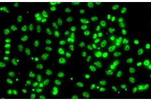 Immunofluorescence analysis of A549 cells using CSRNP1 Polyclonal Antibody (AXUD1 anticorps)
