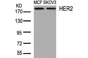 Image no. 2 for anti-Receptor tyrosine-protein kinase erbB-2 (ErbB2/Her2) (AA 1246-1250) antibody (ABIN197227) (ErbB2/Her2 anticorps  (AA 1246-1250))