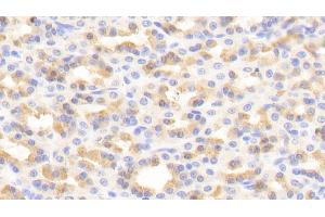 Detection of ERK2 in Rat Stomach Tissue using Polyclonal Antibody to Extracellular Signal Regulated Kinase 2 (ERK2)