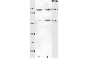 Lane 1: mouse embryo lysates Lane 2:rat brain lysates probed with Anti HSF1 Polyclonal Antibody, Unconjugated (ABIN703676) at 1:200 in 4 °C.