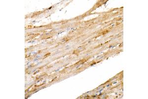 Immunohistochemistry of paraffin-embedded rat heart using PGC1α Rabbit mAb  at dilution of 1:1000 (40x lens). (PPARGC1A anticorps)