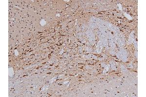 ABIN6267326 at 1/200 staining Rat brain tissue sections by IHC-P. (Tyrosine Hydroxylase anticorps  (pSer40))
