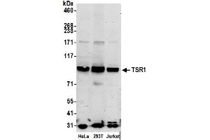 anti-TSR1, 20S rRNA Accumulation, Homolog (TSR1) (AA 25-75) antibody