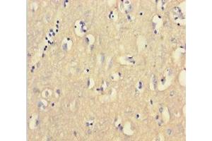 Immunohistochemistry of paraffin-embedded human brain tissue using ABIN7147334 at dilution of 1:100 (CNBP anticorps  (AA 2-170))