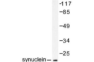 Image no. 1 for anti-Synuclein, alpha (SNCA) antibody (ABIN271837) (SNCA anticorps)