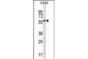 MOSPD2 Antibody (N-term ) (ABIN657246 and ABIN2846344) western blot analysis in CEM cell line lysates (35 μg/lane). (MOSPD2 anticorps  (N-Term))