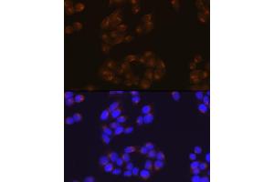 Immunofluorescence analysis of HeLa cells using APP Rabbit mAb (ABIN7265575) at dilution of 1:100 (40x lens). (APP anticorps)