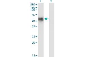 Western Blot analysis of GAK expression in transfected 293T cell line by GAK monoclonal antibody (M01), clone 4C10.