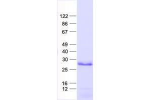 Validation with Western Blot (C11ORF70 Protein (His tag))